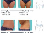 Здоровье, красота,  Здоровье Коррекция веса, Фото